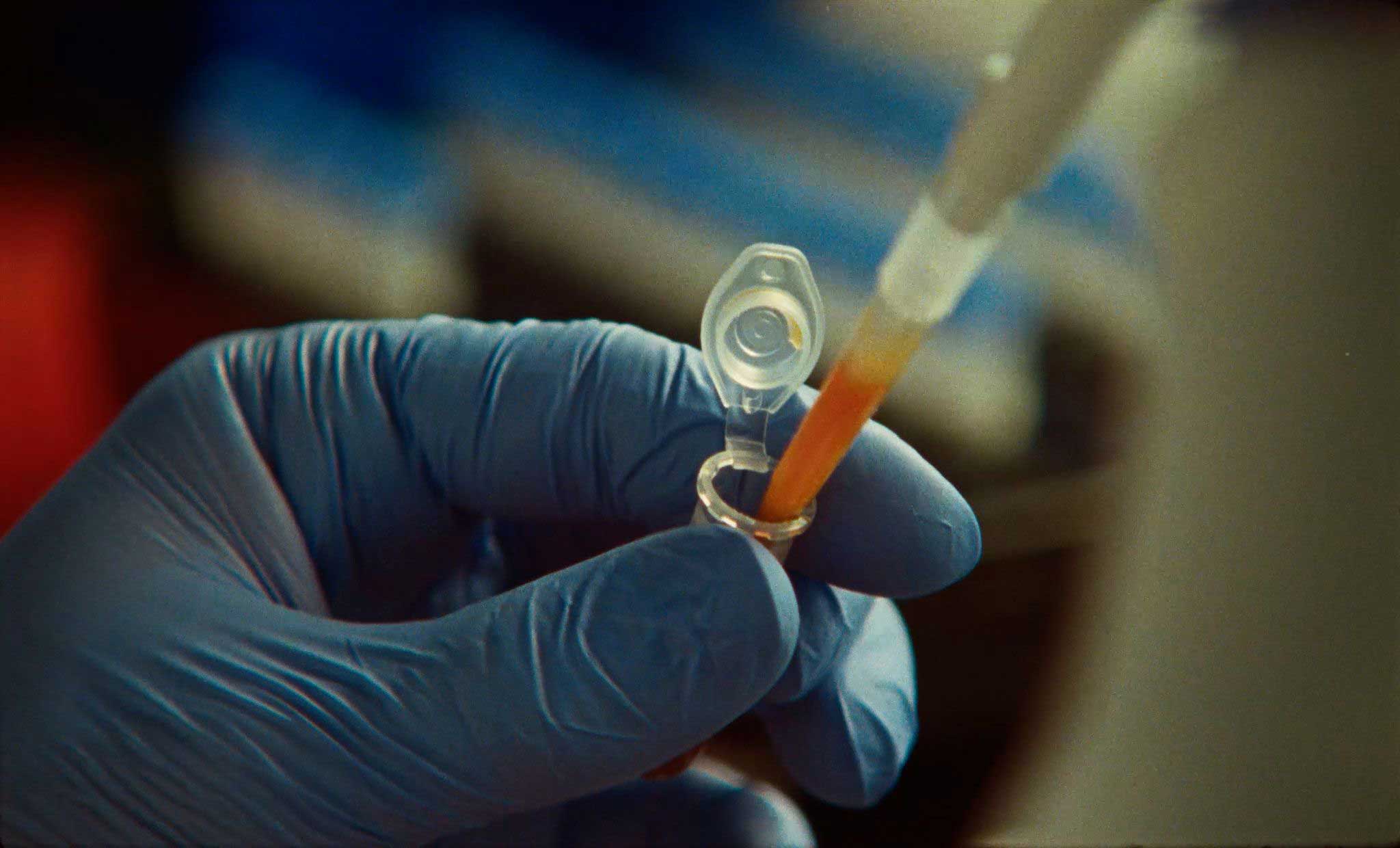 Claude Found a CRISPR-Like Enzyme System by Searching 200,000 Proteins